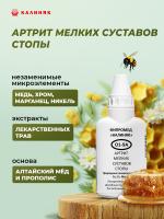 О1-9A Артрит мелких суставов стопы