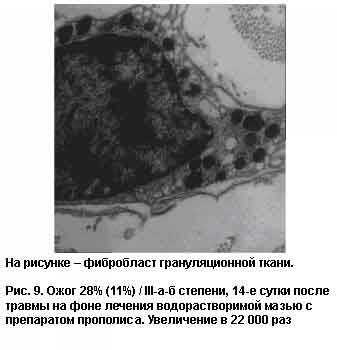 oghog-na-14-sutki.jpg