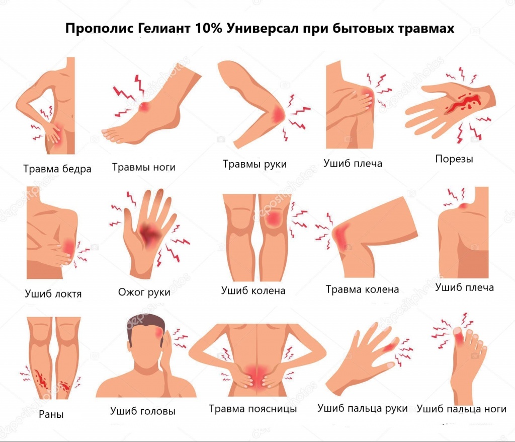 Прополис Гелиант - применение при бытовых травмах