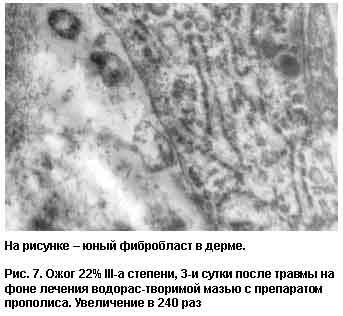 unii-fibroplast-v-derme.jpg unii-fibroplast-v-derme.jpg