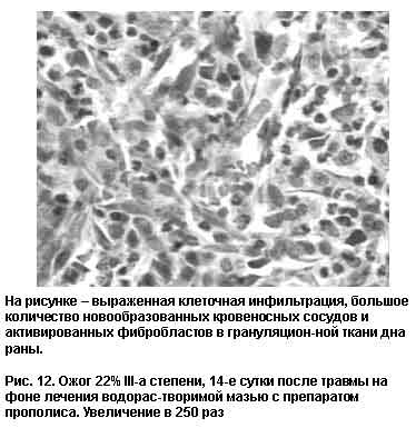 kletochnay-infiltraciya.jpg